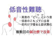 國定鍼灸院/耳の症例