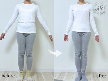 エーアール(AR)の写真/【見直すべきは「骨格」から】身体の歪みや体型変化のお悩みを根本からスッキリ解消◎