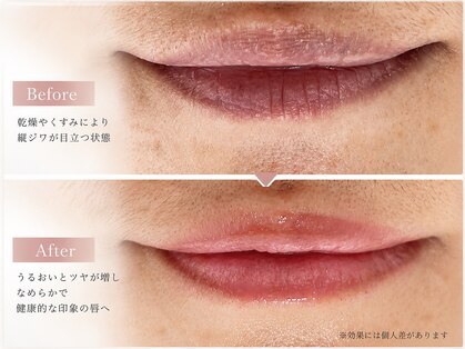 ベルエクラ(Bel Eclat)の写真