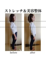 RKY/反り腰が1回で劇的に変化