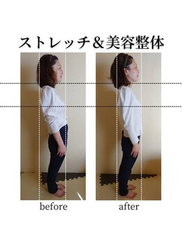 RKY/反り腰が1回で劇的に変化