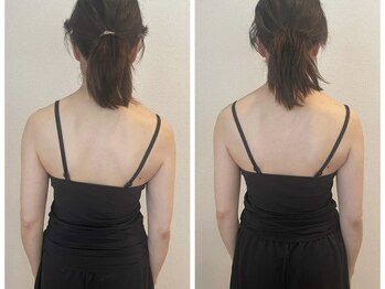 ナチュラルセラピー ドロップ(Drop)/【お悩み】目元・歪み・左右差