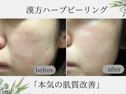 リラクゼーション つぼみの写真