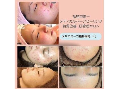 メリアミーゴ(Meli amigo)の写真