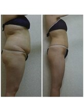 ダリア(DALIA)/健康的にダイエット