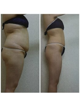 ダリア(DALIA)/健康的にダイエット