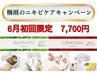 6月ニキビケアキャンペーン！ニキビケアトリートメント6月初回限定7,700円