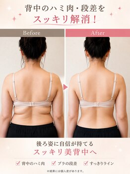 キヨラビューティーの写真/【本気で痩せたい方必見☆】お客様に合ったご提案を致します◎最新の機械導入で理想のスリムボディの実現！
