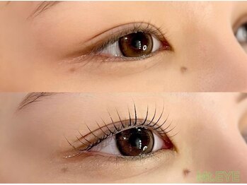 まつげとまゆげの専門店 Mt.EYEの写真/)【十三】まぶたの重さや左右差もクリア◇目元のコンプレックス解消