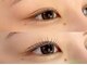 まつげとまゆげの専門店 Mt.EYEの写真/)【十三】まぶたの重さや左右差もクリア◇目元のコンプレックス解消