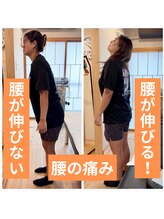 鍼灸整骨院ゼット(Z)/急な腰の痛み