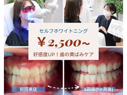 ネージュ(neige)の写真