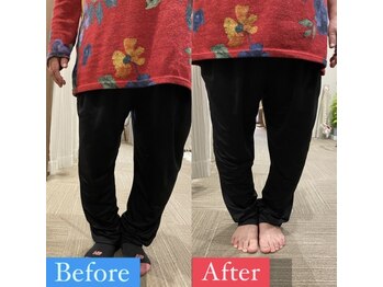 ナオル整体 宮崎院(NAORU整体)/60代女性施術事例【変形膝関節】