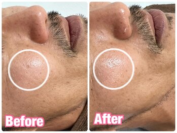 ビューティービューティー(BEAUTY BEAUTY)/陶肌トリートメント