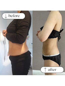 トータルビューティーサロンリア(Li'a)/ビフォー＆アフター