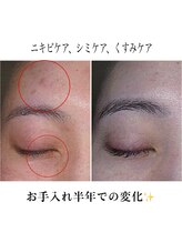 ザ フェース 難波店(THE FAITH)/お客様の肌変化