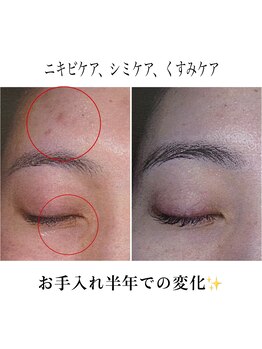 ザ フェース 難波店(THE FAITH)/お客様の肌変化