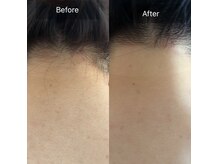 エルモア(L-MORE)の雰囲気（1回でもわかる。結果に高評価！！【脱毛/光脱毛/都度払いあり】）