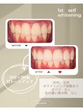 スリール(sourire)/