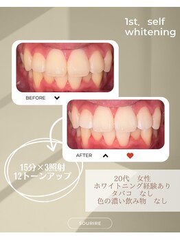 スリール(sourire)/