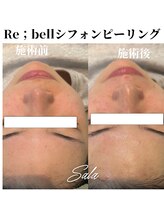 サラ/シフォンピーリング