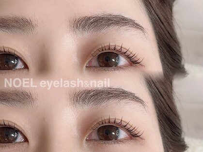 ノエル(NOEL)の写真