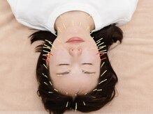 ピアーズ鍼灸整骨院