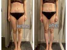 リラル(RERAR)/全身リンパ40分