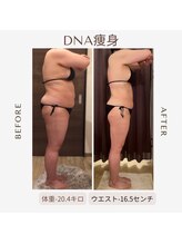 ビーシェイプ 君津(B-Shape)/【痩身】ビフォーアフター