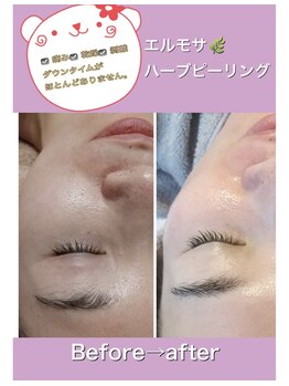 ルミナ(Lumina)/Before→after