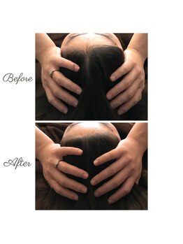 ウルエッテ(UluEtte)/頭小さくなってない？福岡小顔