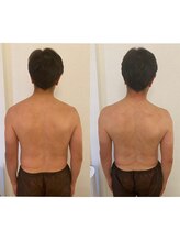 フィオーレ(FIORE)/姿勢改善トリートメント♪