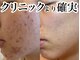 アンドピエル(AndPiel)の写真
