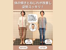 スペックフィジカルコンディショニング(SPECフィジカルコンディショニング)/50代女性/姿勢ビフォーアフター