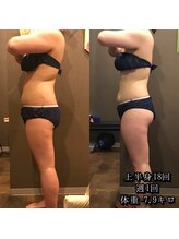 カルム エ コンポーゼ(Calme et Compose')/痩身セルゼロ／上半身18回