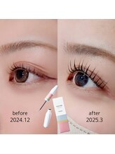 アイラッシュ スタジオ エー 晩翠通り店(eyelash studio Aa)/まつ毛美容液