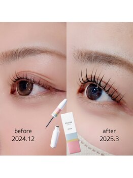 アイラッシュ スタジオ エー 晩翠通り店(eyelash studio Aa)/まつ毛美容液