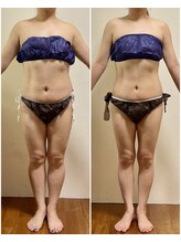 ニコワ(Nicowa)/Nicowaの痩身★BeforeAfter