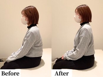 ソレア(Solea)/姿勢改善1回目 Before/After