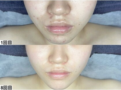 アンドミー 恵比寿店(&me)の写真