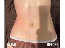 ルナグランデ(Luna grande.)/脂肪分解＋マッサージ