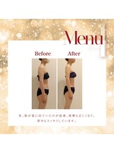 美容整骨小顔ラボ/痩身ビフォーアフター