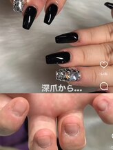 リフュージュ 隠れ家/深爪チビ爪のお悩みも♪アート別