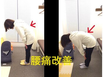 ゆかわ鍼灸整骨院/腰痛