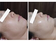 クレール(clair)/肌ツヤ、ハリUPが欲しい方必見！