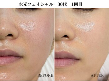 サンビ(SANBI)/毛穴は水分で引き締まる？！