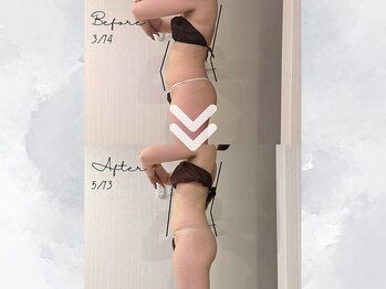 サイバーエステ 宇都宮店/ 身体の「厚み」劇的変化！