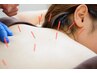 秋のゆらぎケア【なんとなく不調/天気痛/不眠】鍼灸＋全身整体60分/￥6,980!