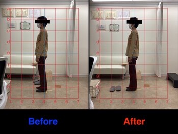 仁 久喜院(JIN)/#足の痛み##幸手#上尾#古河#五霞