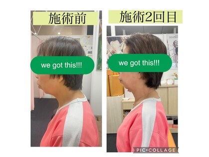 新リンパサロン 大阪の写真